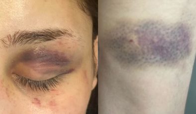 İngiliz çiftten iddia: Antalya’da polise işkence ve cinsel saldırı suçlaması